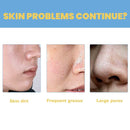 5+5 Free | Clarifying Serum – Unclogs Blackheads for Smooth, Radiant Skin